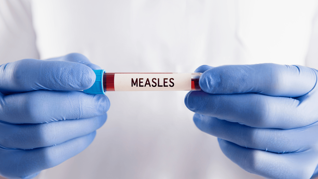 What does measles look like​