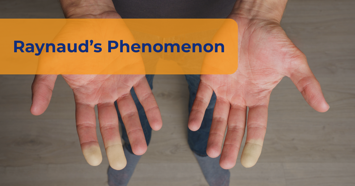 Raynaud’s Phenomenon Relief
