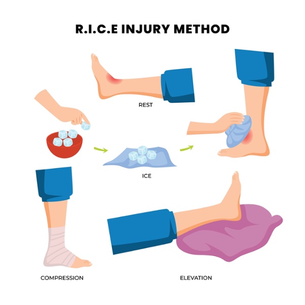 RICE Method Sprains Injury-1